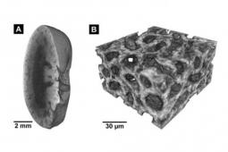 3-D组织学：新染色方法能够对组织样本进行纳米CT成像