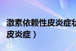 激素依赖性皮炎症状越来越严重（激素依赖性皮炎症）